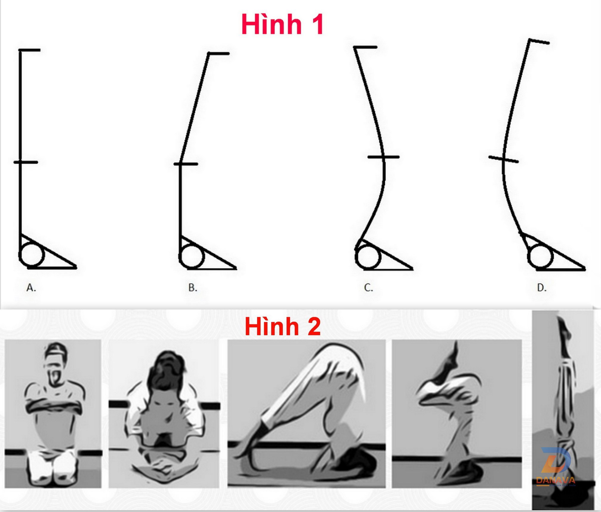 Các kiểu căn chỉnh tư thế Đứng bằng đầu